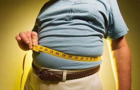 o exceso de peso provoca o desenvolvemento de varices