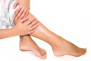 Síntomas de varices veas das pernas en mulleres